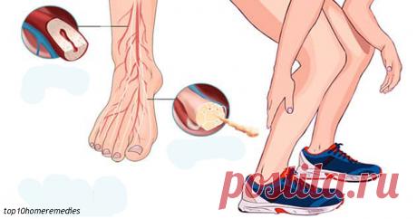 Судороги в ногах: Вот откуда они берутся, и как с этим справиться Когда свело ногу.