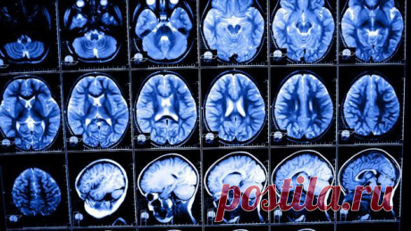 Спасите своих детей от цифрового слабоумия. И это не шутка! | Настройка Здоровья