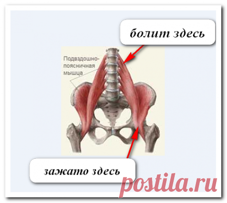 Освобождаем организм от боли (триггерные точки)