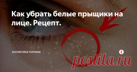 Как убрать белые прыщики на лице. Рецепт. Мелкие белые прыщики могут возникать в зоне глаз, на щеках или подбородке. Выдавливать их ни в коем случае нельзя, так как есть риск задеть волосяные фолликулы и занести инфекцию. В этой статье мы расскажем Вам как решить эту проблему. Натуральное средство вытягивает кожное сало из пор кожи и контролирует работу сальных желез, а также обладает отбеливающим эффектом.
Рецепт
Вам понадобится:
1 бело
