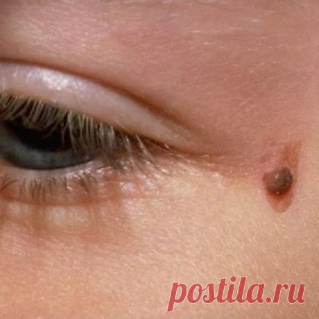 Исправляем недостатки кожи в домашних условиях