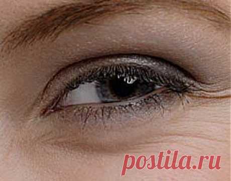 Как убрать мимические морщины под глазами? | Народные средства лечения