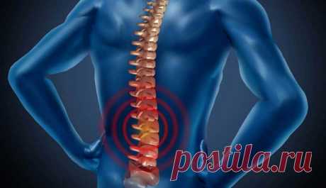 ОСТЕОХОНДРОЗ.