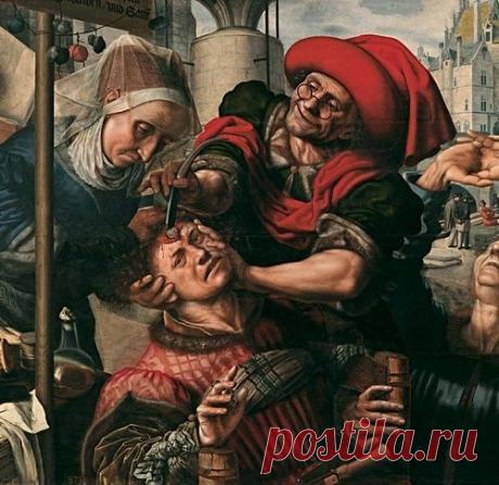 «Камни безумия»: шокирующие примеры средневекового врачевательства