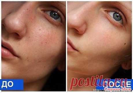 Лоскутное шитье. Тема 2-я. Техника "синель": идеи применения - МирТесен