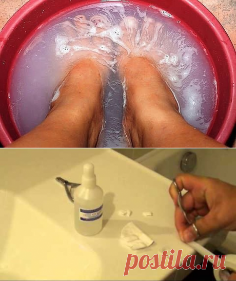 ГРИБОК НОГТЕЙ !!!
*Замучил грибок и потеют ноги? - Вода тёплая 1л, йод 6кап, соль4сл - смешай, опусти ножки на 10-15 мин, и так повторяй до выздоровления
*Перекись - ВидеоМК - лучшего и не придумать!
*Здоровья Вам и никакого грибка - грибы только в лесу, и побольше)))