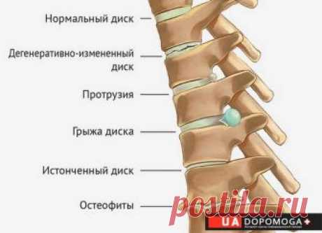 Остеохондроз, заболевания суставов и современные способы их лечения.