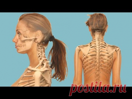 Анатомия шейного отдела позвоночника. Причины боли в шее, симптоматика миозита, шейного прострела