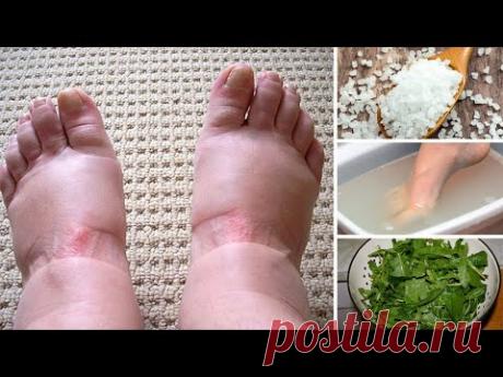 Домашние Средства От Отёкших Ног