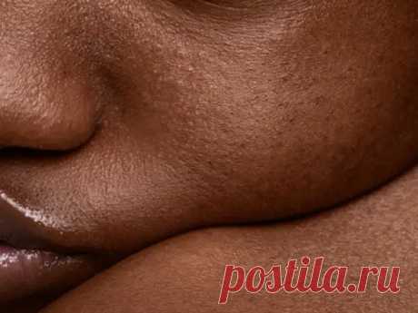 Проблема на поверхности. Как связаны дерматологические заболевания и ментальные расстройства - ПолонСил.ру - социальная сеть здоровья - Медиаплатформа МирТесен