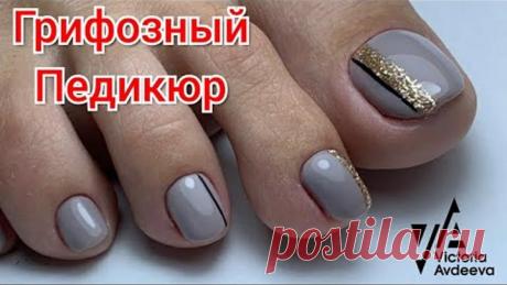 Грифозные ногти. Педикюр. Виктория Авдеева