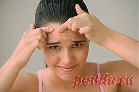 Лавровый лист для избавления от прыщей |Прыщи на лице в любом возрасте – это неприятный сюрприз. Но, конечно, наиболее уязвимы к их появлению молодые люди. И девушки, и парни, увидев в отражении высыпания на коже лица, готовы на все, лишь бы избавиться от них окончательно и бесповоротно.