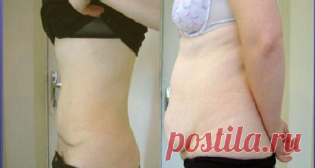 Рецепт приготовления домашнего жиросжигателя, при помощи которого я убрала свисающий живот за 20 дней | Худеем вместе | Яндекс Дзен