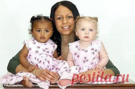 Девочки-двойняшки. Бывает и такое!