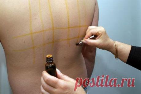 🎅 Все Самое Интересное 🎅
Йодовая сетка: целебные свойства простых линий