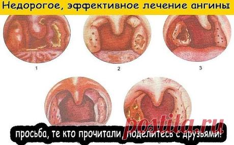 (76) Одноклассники