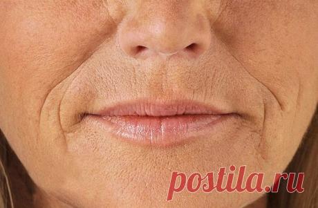 Заметили, что кожа вокруг губ стала обвисать? Немедленно сотрите «складки скорби» с лица!
Ужасные «складки скорби» досаждают едва ли не каждой женщине, переступившей порог 35 лет. С таким дефектом способна справиться лишь одна пластическая операция — общая подтяжка кожи средней трети лиц…