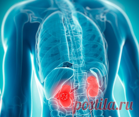 6 вредных привычек, которые повреждают почки Не зря в народе прижилась пословица: «Поздно пить боржоми, когда почки отказали». Этот парный орган работает на износ: когда его функция снижается до 20 %, он всё еще способен поддерживать полноценную…