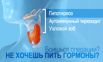 Противозачаточные таблетки