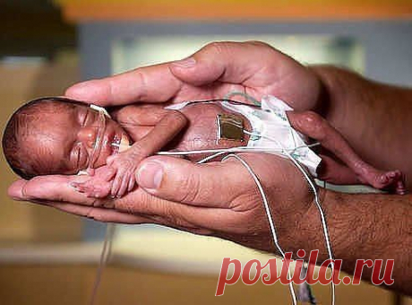 РЕБЁНОК ВЫЖИВШИЙ В РЕЗУЛЬТАТЕ АБОРТА / Новые дети