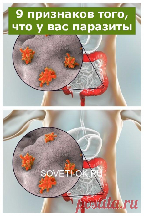 9 признаков того, что у вас паразиты