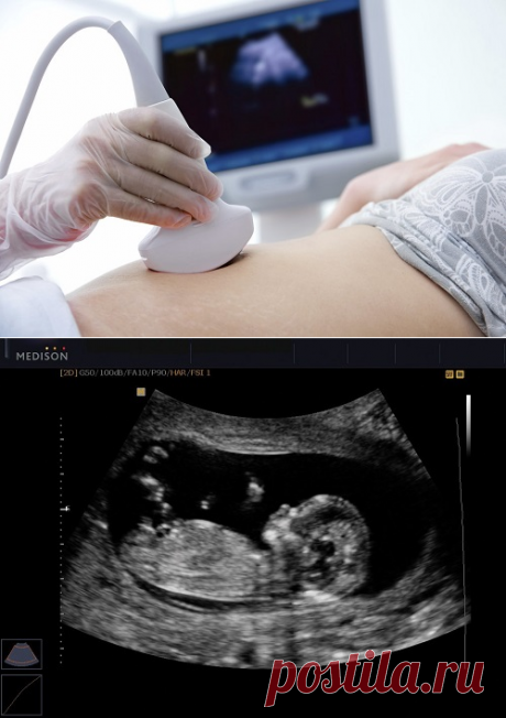 Подготовка к УЗИ - обследованию и как его делают