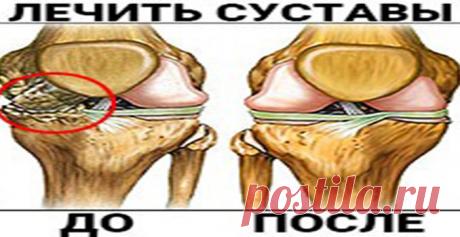 Артроз смертельно опасен! Чтобы не стать инвалидом и вылечить СУСТАВЫ и СПИНУ дома, нужно на ночь мазать густым… — Полезные советы