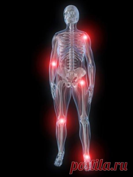 (+1) - 6 народных способов лечения ревматизма | ВСЕГДА В ФОРМЕ!