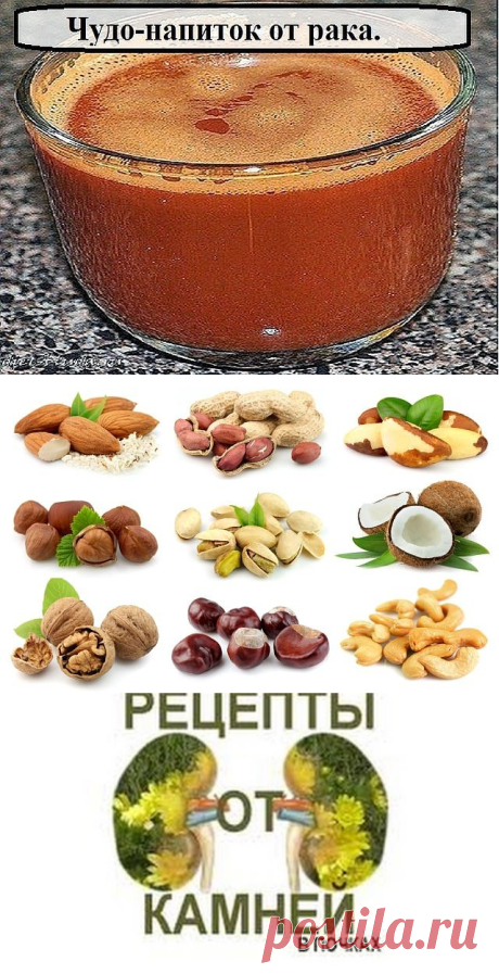 (47) Одноклассники