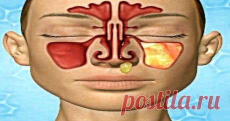 И багровыми реками потекут все сопли: 2 простых домашних средства против заложенности носа