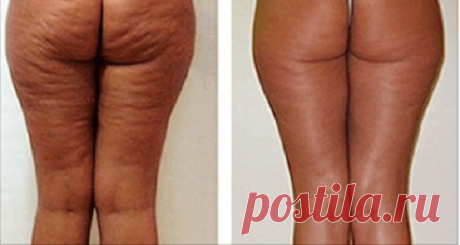 Lo que ella se unta en el trasero, todos lo tienen en casa, ¡pero nadie lo usa! – Hoy En Belleza de Bella Y Belleza
Просматривайте этот и другие пины на доске Best of пользователя Elena.
Теги
Lo que ella una se unita en el trascero, todo lo tienes en casa y todavía no usa!
¡Hoy en Belleza y Bellezas!
Просматривайте этот и другие пины на доске Ladies пользователя Linda Marie.
Теги
Что говорят другие
Gallery of House / Katerina Dyagileva - 21
The House is a contemporary house designed …