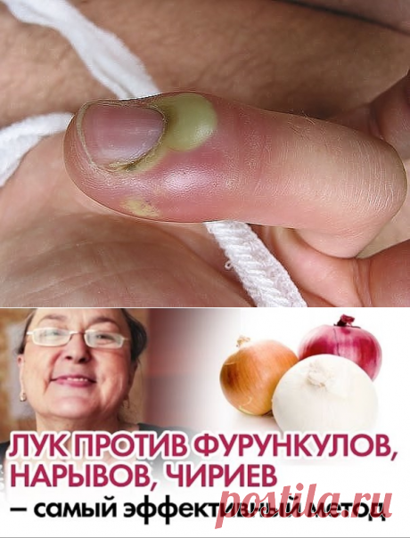 (99) Одноклассники