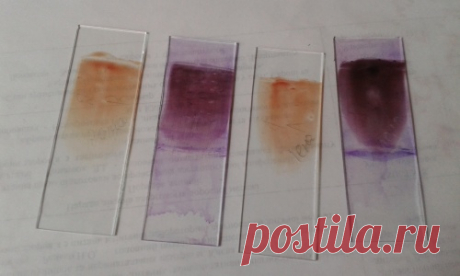 Записки лаборанта. Общий анализ крови: лейкоциты и СРБ   Врач-лаборант Кузняк Ирина: "Количество лейкоцитов в ОАК занимает ведущее место, а формула — уточняющее. Но врач сопоставляет все показатели с клиникой, чтобы взвешенно принять решение и назначить лечение."