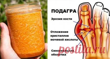 Попрощайтесь с подагрой навсегда с помощью этого мощного природного лечения!