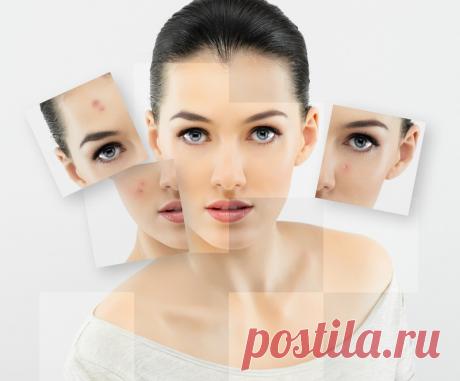 Гепариновая мазь для лица