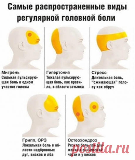 Давление или мигрень? 7 причин головной боли и что делать - Хитрости Жизни - медиаплатформа МирТесен Говорят, голова болит у всех, но у всех она болит по-разному. А можно ли самостоятельно определить, какой вид головной боли мешает жить? Отвечает профессор кафедры госпитальной терапии РНИМУ им. Пирогова Александр Карабиненко, aif.ru: - Сильнее и чаще всего голова болит у людей с 25 до 45 лет - в