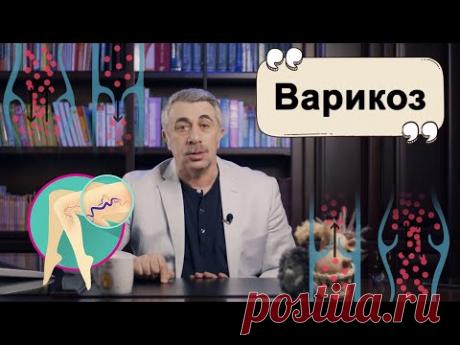 Варикоз.