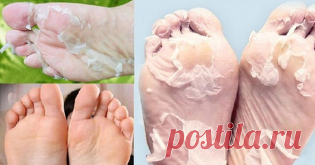 Супер средство для идеальных пяточек!