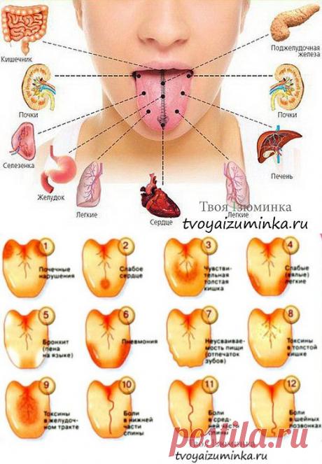 ЯЗЫК СКАЖЕТ О ТЕБЕ !!! **Наш язык -простейшая диагностика заболеваний. Цвет, размер и кожа языка -это индикаторы здоровья.