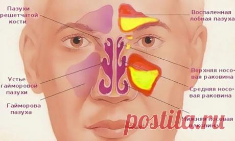 Карта желаний 2 или VisuaLife — мобильное приложение для визуализации КАК ОЧИСТИТЬ ГАЙМОРОВЫЕ И ЛОБНЫЕ ПАЗУХИ - Карта желаний 2 или VisuaLife - мобильное приложение для визуализации