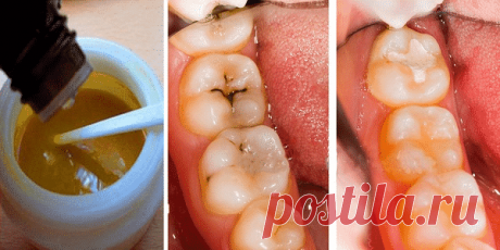 Эта маска для зубов оставит стоматологов без работы! Всего 4 компонента… 🌶 Кликните, чтобы открыть или оставить комментарий👆
