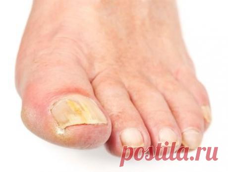 Домашние средства, которые лечат