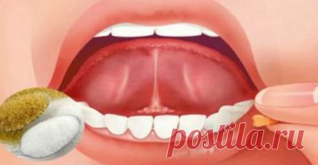 Откройте для себя силу помещения соли и сахара под язык
Люди, страдающие бессонницей, должны знать, что соль и сахар — это идеальное сочетание. Оно может быть эффективным и поможет хорошо выспаться.
Страдая бессонницей, — расстройством, которое вызыва…