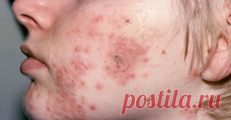 Осторожно! Нынче в общественном транспорте гуляют страшные инфекции… Защити себя!