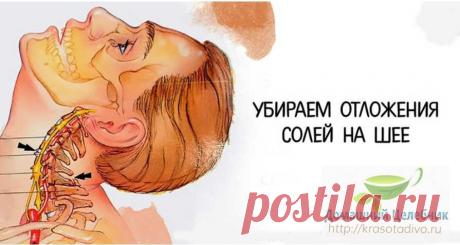 Избавляемся от солей на шее: просто и эффективно Доктор Виктор Васильевич Ченцов, известный мануальный терапевт, разработал специальный гимнастический комплекс, который прекрасно подойдет в качестве профилактического средства против заболеваний суст…