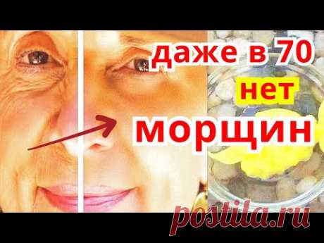 Даже в 70 Лицо Подтянется ! Кожа Как у Ребёнка Маска для Лица от Морщин .Рецепт