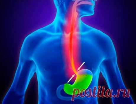 Добавки от изжоги, кислотного рефлюкса и несварения - Народная медицина - медиаплатформа МирТесен Изжога, кислотный рефлюкс, несварение — типичные дисфункции верхних отделов ЖКТ, они не связаны с развитием язв. Кроме изжоги, симптомами кислотного рефлюкса являются проблемы с глотанием, чувство тяжести / вздутия после приема пищи, боль и спазмы в области желудка / нижней области живота. Изжога и