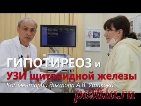 Гипотиреоз УЗИ щитовидной железы Лечение щитовидной железы Доктор Ушаков