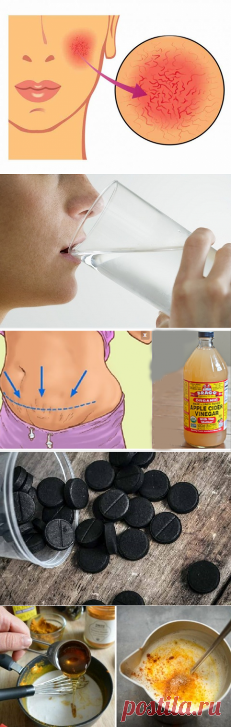 Безопасные и эффективные домашние средства для разрушенных кровеносных сосудов