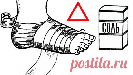 Солевые повязки: старинный метод, который помогает при болях, отёках и воспалениях — без таблеток и уколов | Советы для здоровья | Дзен